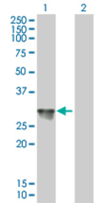 Lane 1: SSX2 transfected lysate (24.64 KDa). Lane 2: Non-transfected lysate.