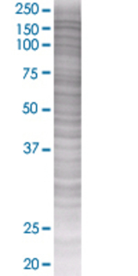PDGFRB transfected lysate.