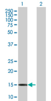Lane 1: CSF3 transfected lysate (22.88 KDa) Lane 2: Non-transfected lysate.