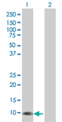 Lane 1: GNRH1 transfected lysate (10.12 KDa). Lane 2: Non-transfected lysate.