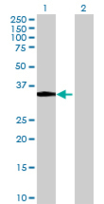 Lane 1: SGCG transfected lysate (32.12 KDa) Lane 2: Non-transfected lysate.