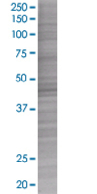 MRPS9 transfected lysate