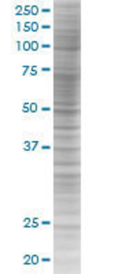 MIR16 transfected lysate.