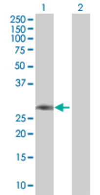 Lane 1: CD8B transfected lysate (27.2 KDa) Lane 2: Non-transfected lysate.