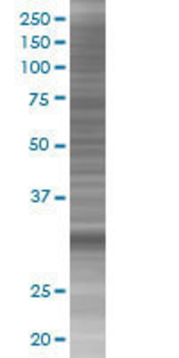 ANXA4 transfected lysate.