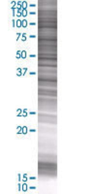 FOXL1 transfected lysate.
