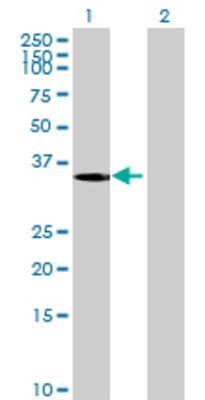 Lane 1: FOXL1 transfected lysate (38.06 KDa) Lane 2: Non-transfected lysate.