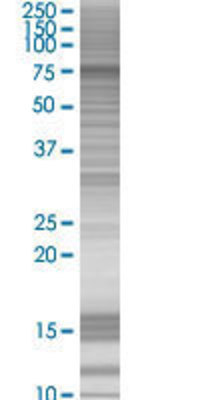 MPP3 transfected lysate.