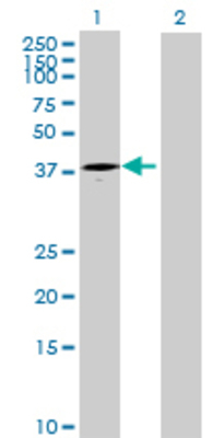 Lane 1: ART4 transfected lysate (34.65 KDa) Lane 2: Non-transfected lysate.