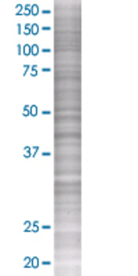HLA-C transfected lysate.