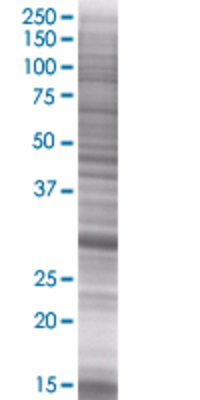 TRH transfected lysate.