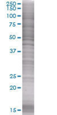 TNFRSF11B transfected lysate