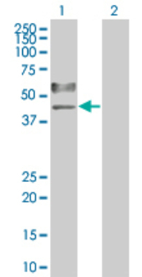 Lane 1: TNFRSF11B transfected lysate (46 KDa). Lane 2: Non-transfected lysate.