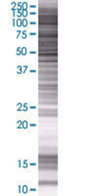 GPX7 transfected lysate.