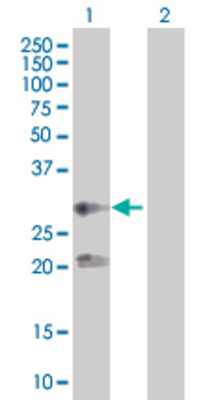 Lane 1: C5orf19 transfected lysate (27.83 KDa). Lane 2: Non-transfected lysate.