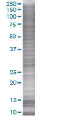 C5orf19 transfected lysate