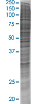 HADHA transfected lysate.