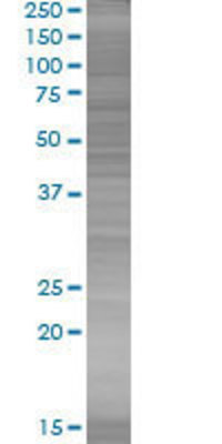 SIGIRR transfected lysate.