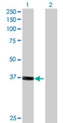 Lane 1: SORBS3 transfected lysate (36.7 KDa) Lane 2: Non-transfected lysate.