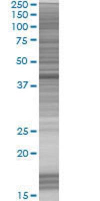SORBS3 transfected lysate.
