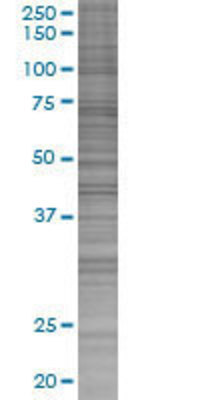 POLR1C transfected lysate.