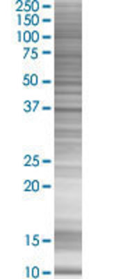 CIAPIN1 transfected lysate.