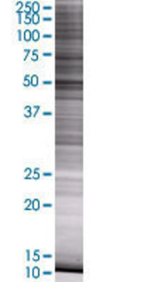CYP2A6 transfected lysate.
