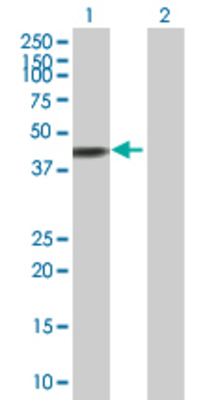 Lane 1: CPA2 transfected lysate (45.98 KDa) Lane 2: Non-transfected lysate.