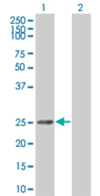 Lane 1: IKBKB transfected lysate (28.27 KDa) Lane 2: Non-transfected lysate.