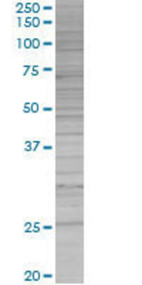 IKBKB transfected lysate.