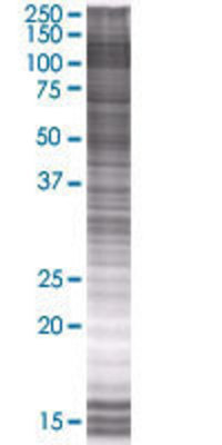 DPP4 transfected lysate.