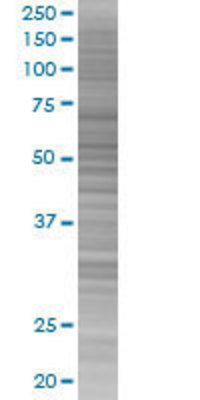 CYP27A1 transfected lysate.