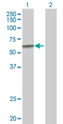 Lane 1: CYP27A1 transfected lysate (60.2 KDa) Lane 2: Non-transfected lysate.
