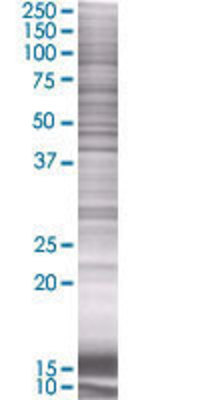 ARL6IP4 transfected lysate.
