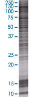 ZHX3 transfected lysate.