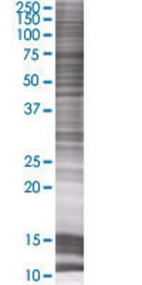 FYCO1 transfected lysate.