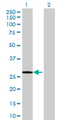 Lane 1: FYCO1 transfected lysate (28.16 KDa) Lane 2: Non-transfected lysate.