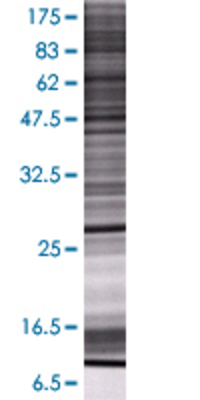 GSTM4 transfected lysate.