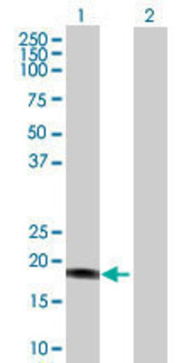 Lane 1: GSTM4 transfected lysate (24.09 KDa) Lane 2: Non-transfected lysate.