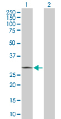 Lane 1: RAD1 transfected lysate (31.8 KDa). Lane 2: Non-transfected lysate.