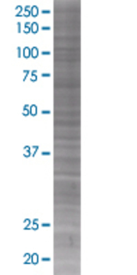 RAD1 transfected lysate