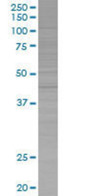 DHCR7 transfected lysate.