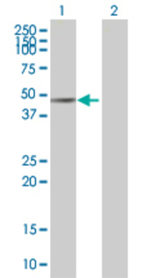 Lane 1: DHCR7 transfected lysate (54.5 KDa) Lane 2: Non-transfected lysate.