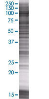 PPFIBP2 transfected lysate.
