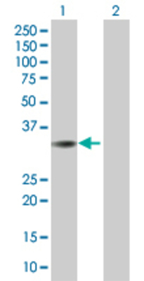 Lane 1: SFXN2 transfected lysate (35.53 KDa). Lane 2: Non-transfected lysate.