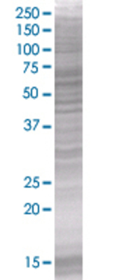 NAP1L1 transfected lysate