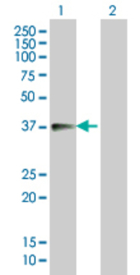 Lane 1: LYPD5 transfected lysate (27.5 KDa). Lane 2: Non-transfected lysate.