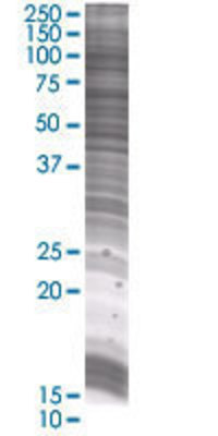 GTF3C2 transfected lysate.