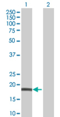 Lane 1: NUDT1 transfected lysate (18 KDa) Lane 2: Non-transfected lysate.
