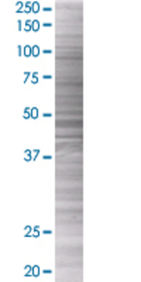 NUDT1 transfected lysate.